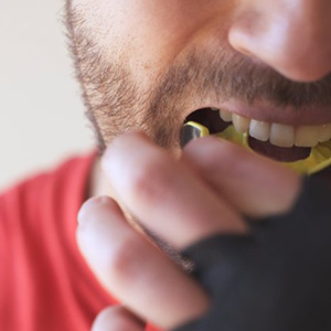 Man inserting an athletic mouthguard