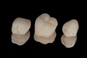 Three tooth-colored dental crowns on a black reflective surface